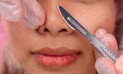 How to Prep Your Skin for Dermaplaning